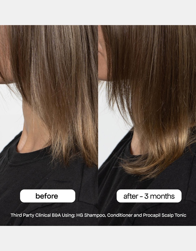 Bondi Boost - Anti-Thinning Procapil® Scalp Tonic