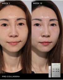 Vida Glow - Pro Collagen+