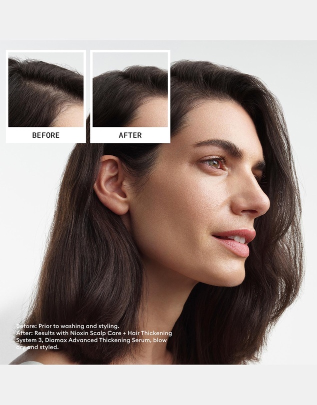 Nioxin - Nioxin Scalp + Hair Thickening System 3 - Hair Thickening System For Colored Or Dry Damaged Hair With Light Thinning