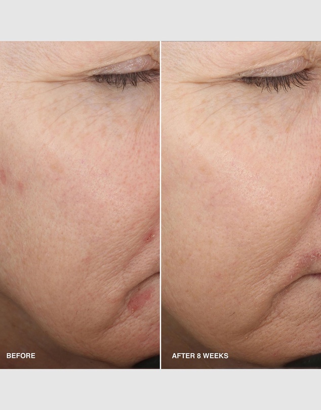 Bobbi Brown - Vitamin Enriched Smoothing Serum