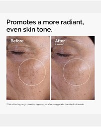 The Ordinary - Glycolic Acid 7% Toning Solution - 240ml