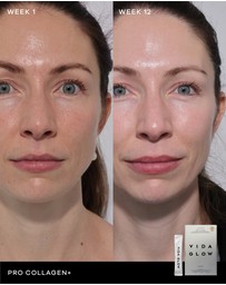 Vida Glow - Pro Collagen+