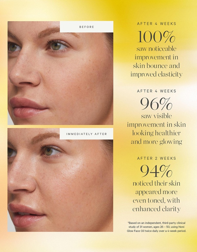 KORA Organics - Noni Glow Face Oil