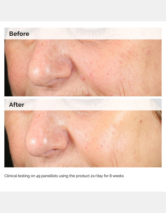The Ordinary - Alpha Arbutin 2% + HA - 60ml
