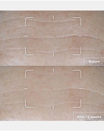 Clinique - Smart Clinical Repair SPF 15 Wrinkle Correcting Cream