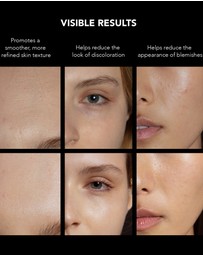 FOREO - FAQ 202