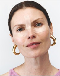 Wrinkles Schminkles - Self-Dissolving Microneedle Patches
