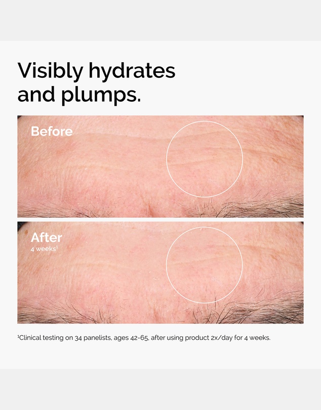 The Ordinary - Hyaluronic Acid 2% + B5