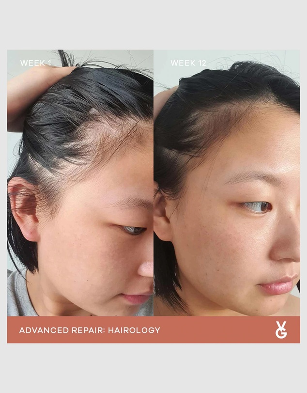 Vida Glow - Hairology™