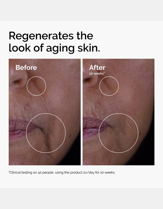 The Ordinary - GF 15% Solution