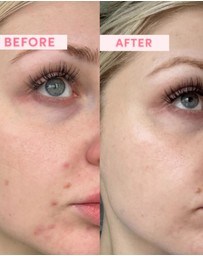 SAND & SKY - Australian Pink Clay Resurfacing Face Mask