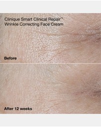 Clinique - Smart Clinical Repair™ Wrinkle Correcting Cream