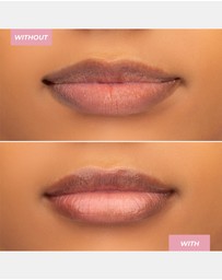MCoBeauty - Hyaluronic Ultra-Treatment Lip Balm