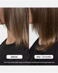 Bondi Boost - Anti-Thinning Procapil® Scalp Tonic