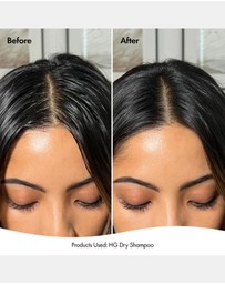 Bondi Boost - Hair Growth Dry Shampoo