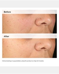 The Ordinary - Alpha Arbutin 2% + HA - 60ml