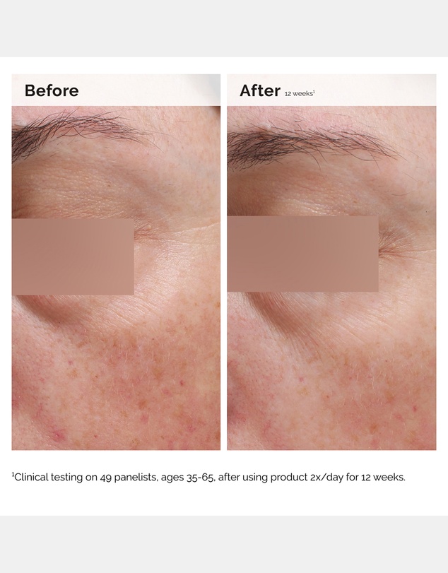 The Ordinary - Niacinamide 5% Face and Body Emulsion