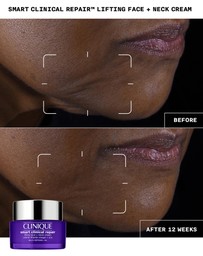 Clinique - Smart Clinical Repair Lifting Face + Neck Cream