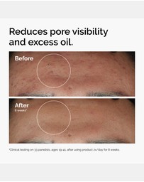 The Ordinary - Niacinamide 10% + Zinc 1% 60ml