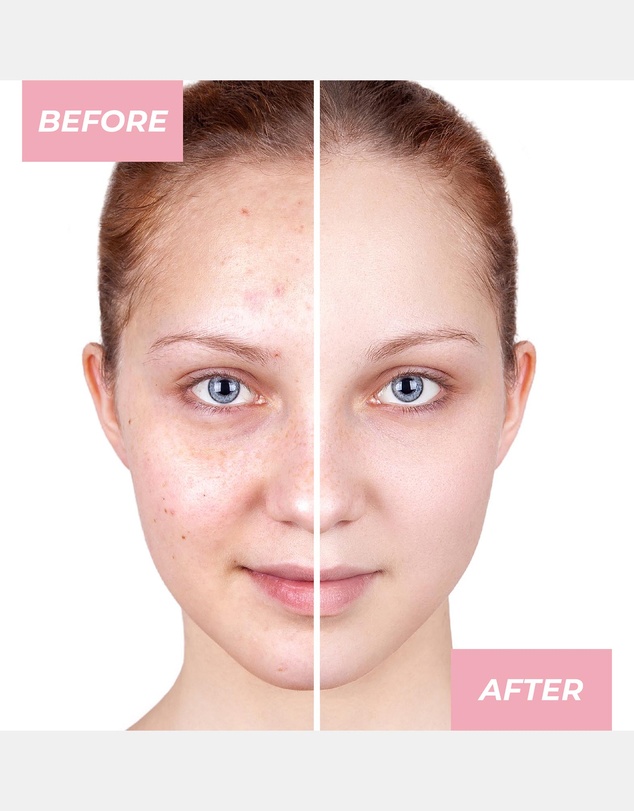 MCoBeauty - Glow Boost Vitamin C Serum 30ml
