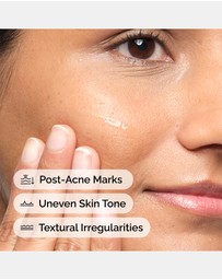 The Ordinary - Aloe 2% + NAG 2%