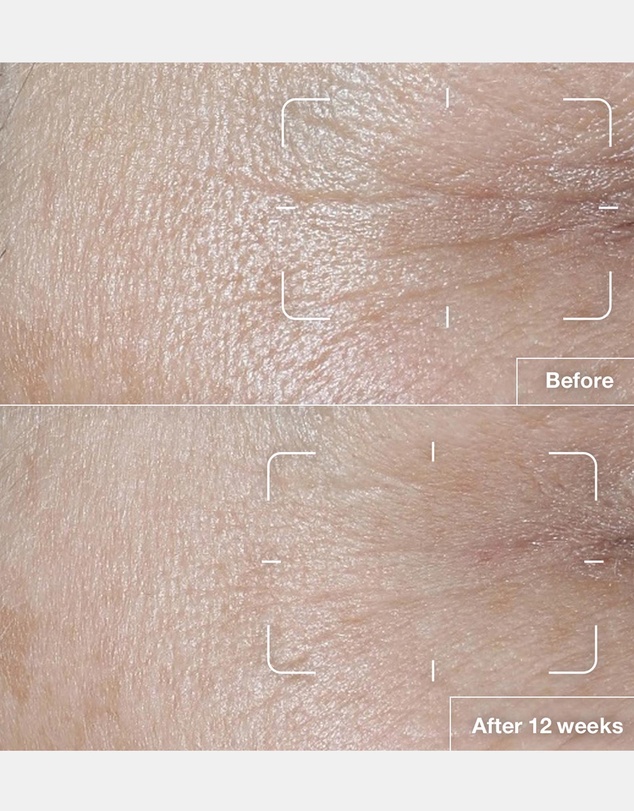 Clinique - Smart Clinical Repair SPF 15 Wrinkle Correcting Cream